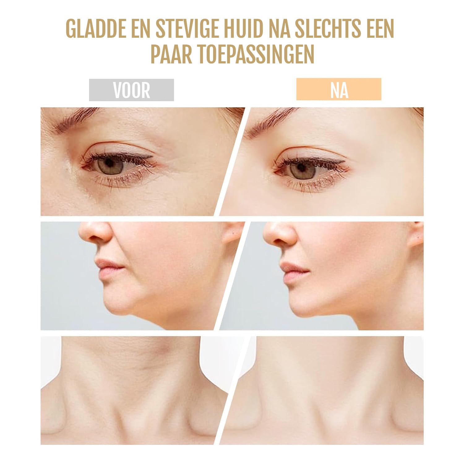 Dermaluxe – dispositivo de lifting facial 7 en 1 con EMS e terapia de luz