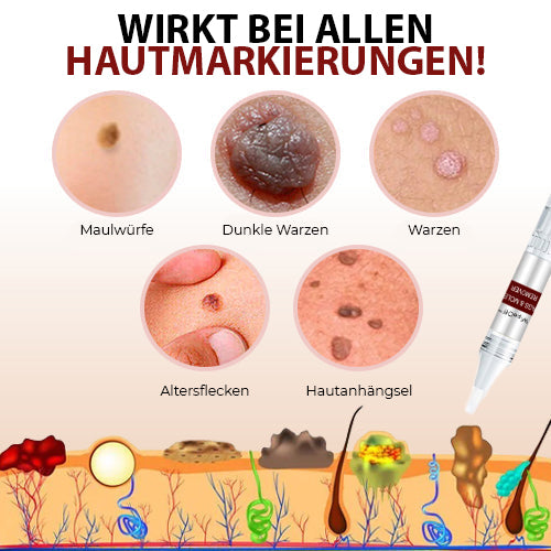 DermaPure Removedor de Etiquetas da Pel – Solución Indolora e Segura para unha Pel Lisa