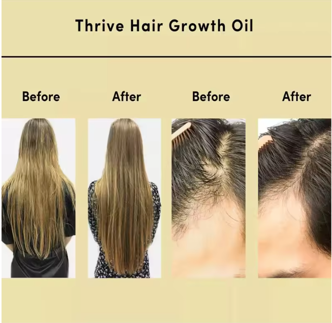 Huile capillaire pour cuir chevelu – Ricin, Argan &amp; Noix de coco pour éclat &amp; croissance des cheveux
