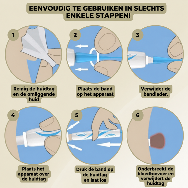 Huidverzorgingspen – Nauwkeurige Applicatie &amp; Compact Ontwerp voor Thuisgebruik Vestragear