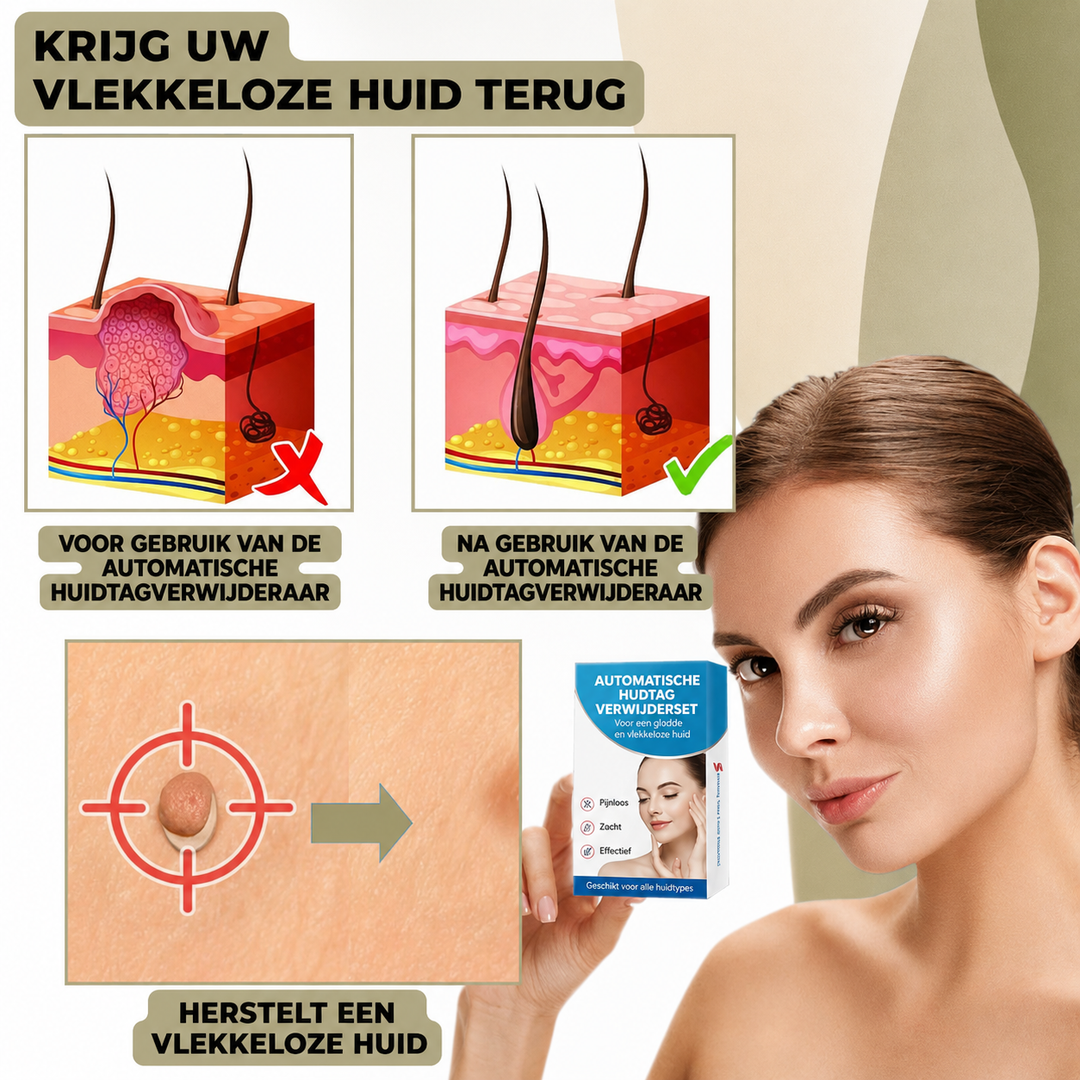 Huidverzorgingspen – Nauwkeurige Applicatie &amp; Compact Ontwerp voor Thuisgebruik Vestragear