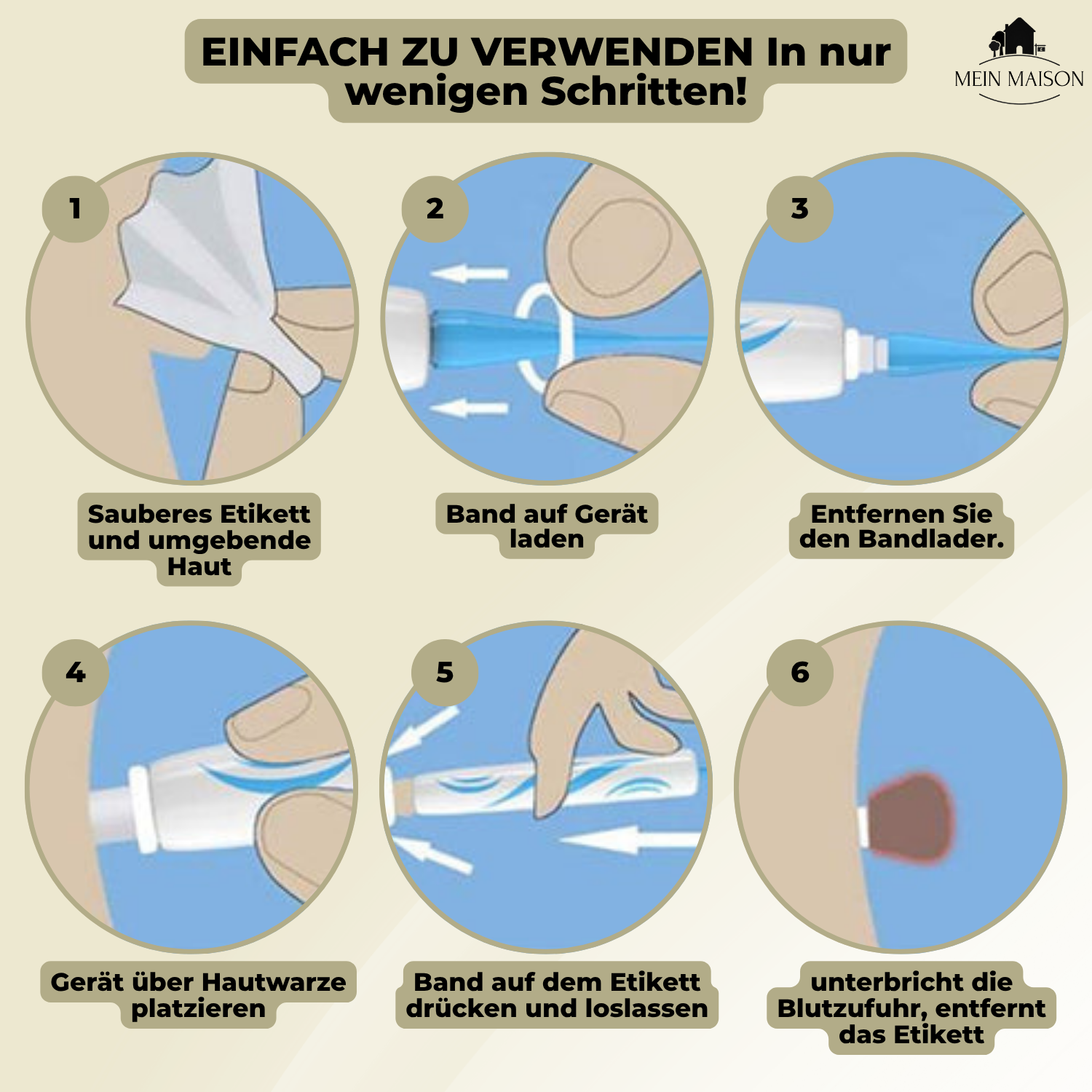 DermaLinx Wrattenverwijderaar | Pijnloze Verwijdering van Wratten & Moedervlekken | Voor Thuis | Zonder Operatie 6
