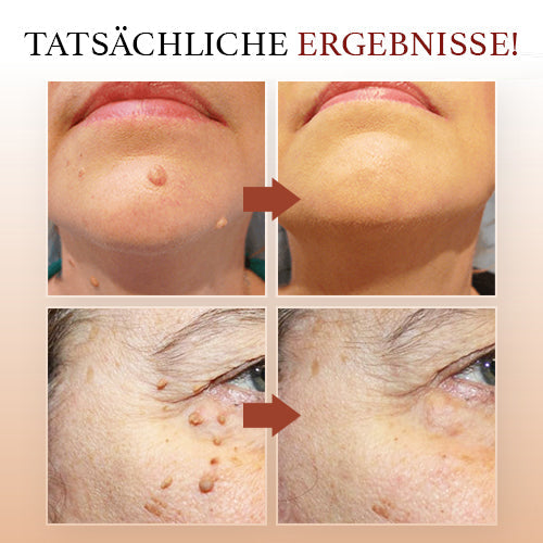 DermaPure Enlève-étiquettes de peau – Solution indolore et sûre pour une peau uniforme