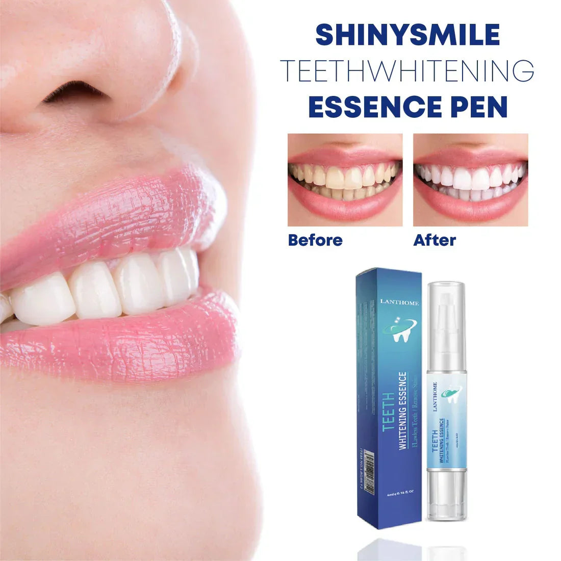 LumiSmile Whitening Essence – Cura dentale delicata ed efficace