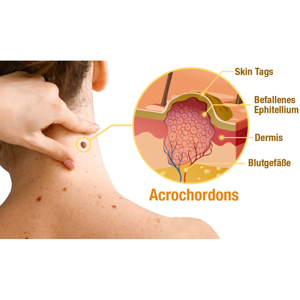 Dermavive – Spray per la pelle con estratto di api per macchie e verruche