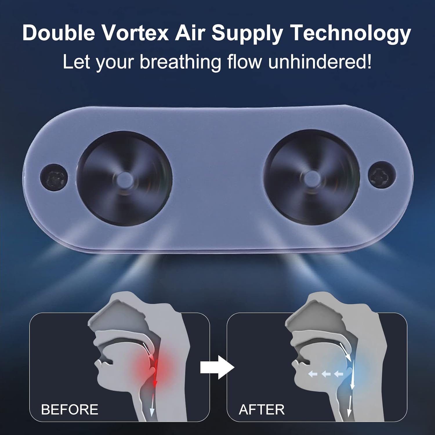 Somnix CPAP Micro – Appareil de sommeil silencieux et sans masque pour la maison et les voyages