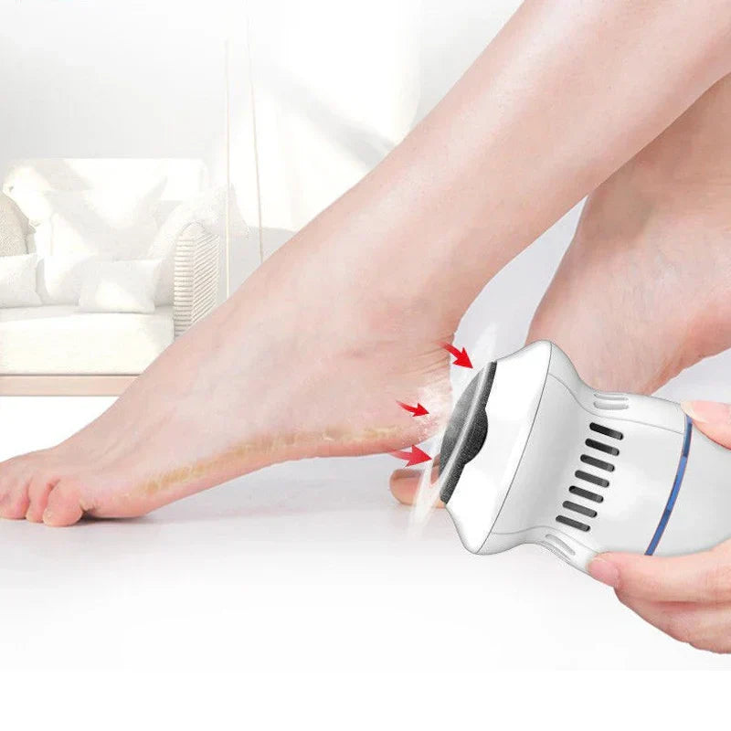 Pedivio – Éliminateur électrique de callosités avec aspiration pour des pieds doux