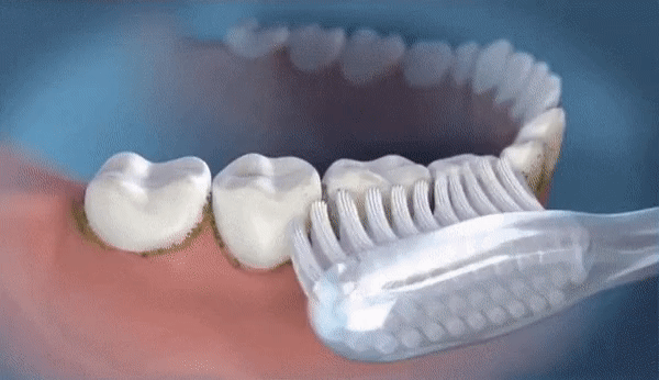 SMILEFRESH – Waterflosser met 3 drukinstellingen en 360°-mondstuk 5