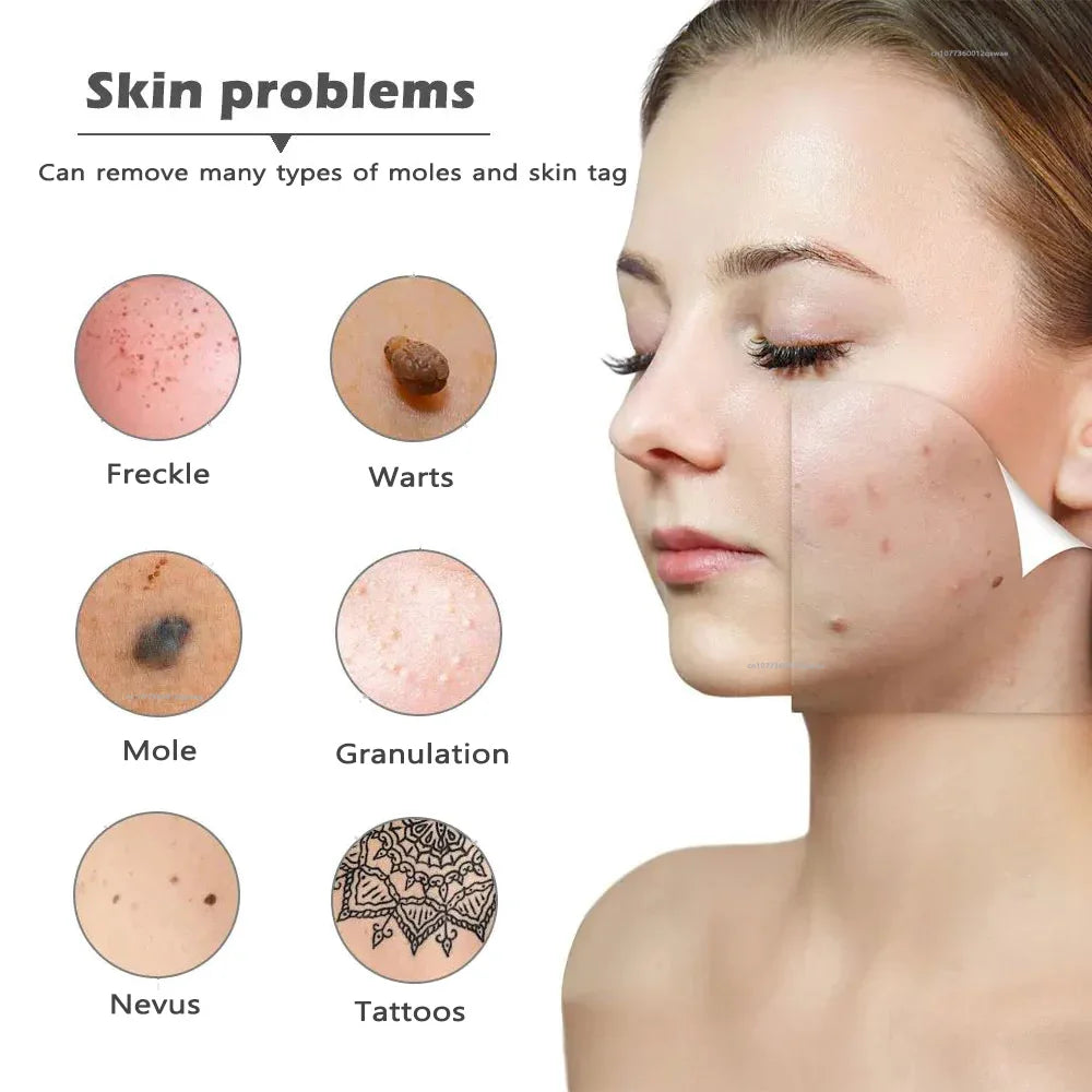 ClearSkin Rimuovi Macchie – Indolore & Efficace per Casa