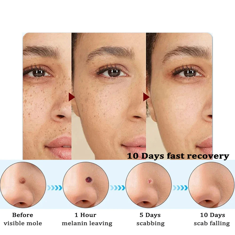 ClearSkin Détachant – Indolore &amp; Efficace pour la Maison