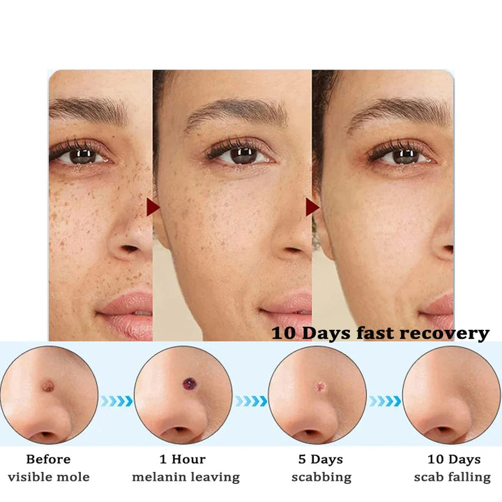 ClearSkin Détachant – Indolore &amp; Efficace pour la Maison